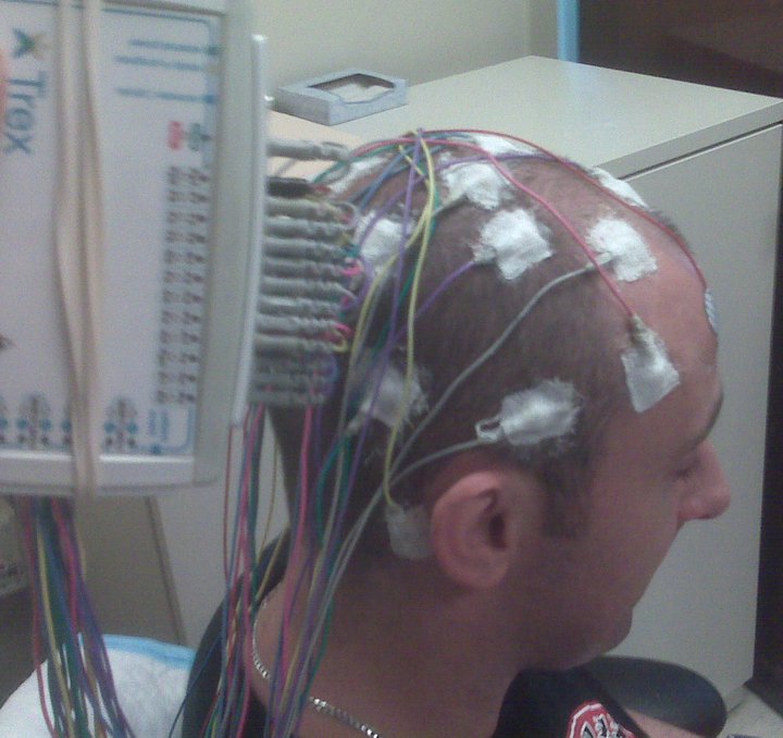 Mighty Mike Simmel EEG
